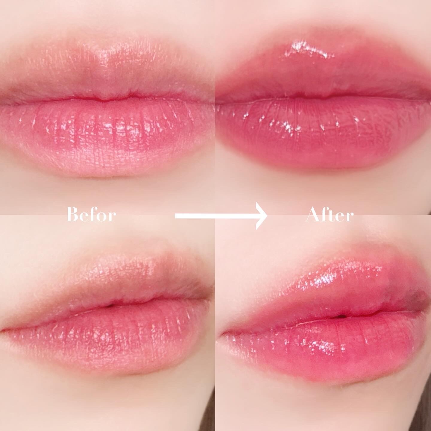 ドトムリッププラスプランパー/keybo/リッププランパーを使ったクチコミ（3枚目）