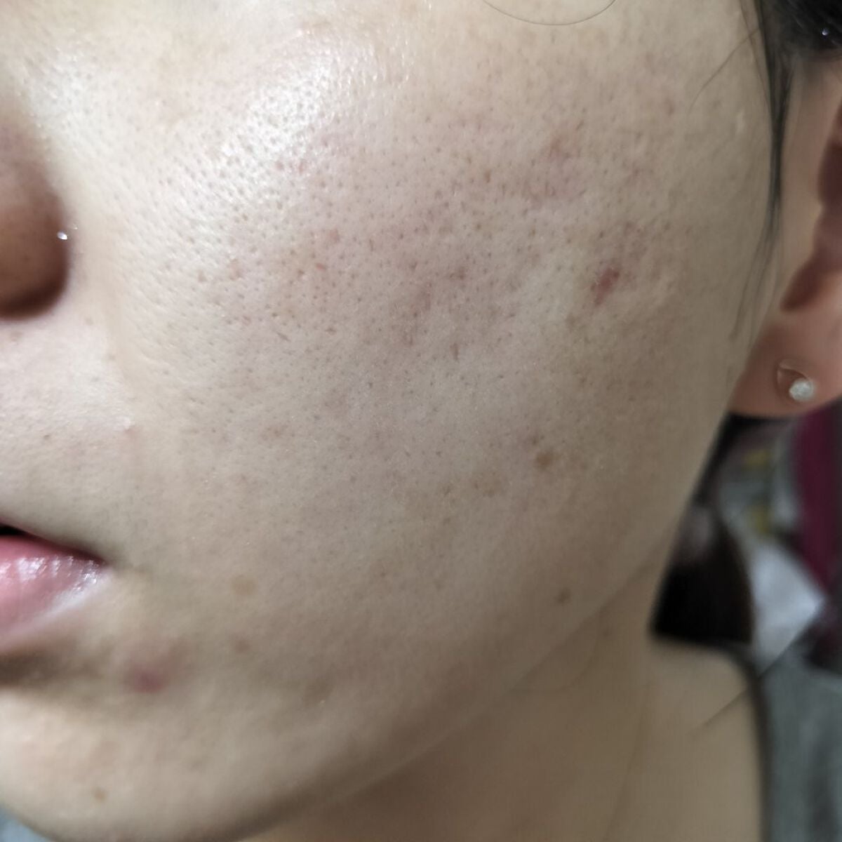 ビオオイル アルガンオイル/Melvita/フェイスオイルを使ったクチコミ(2枚目)