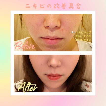 ハウス オブ ローゼ アクネ クリア ジェルパックのクチコミ「こんばんは🌙
今回、ご紹介するのは私が最近しているお風呂🛁でのスキンケアをご紹介しようと思い.....」(3枚目)