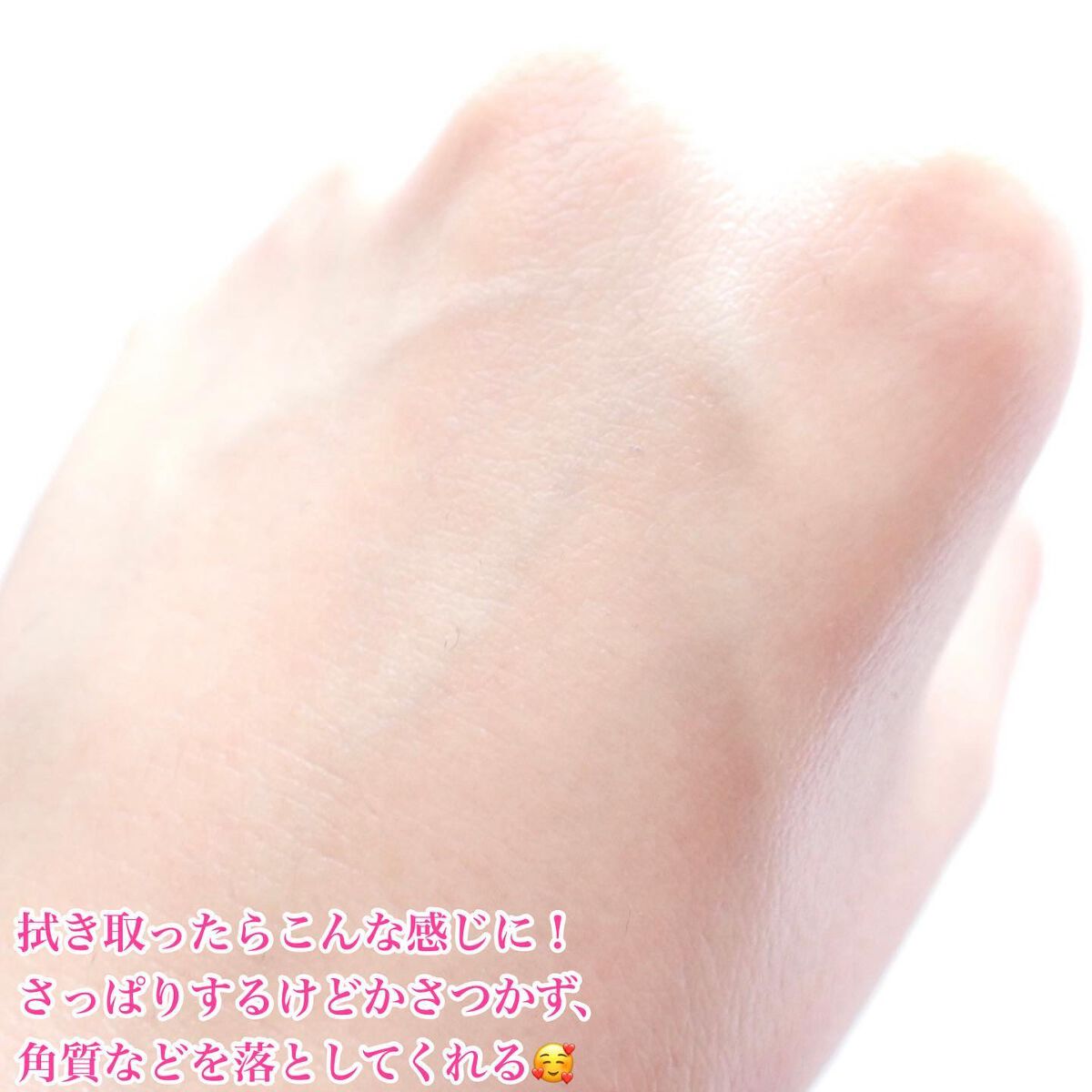 CICAピュリファイング トナー/ロベクチン/化粧水を使ったクチコミ(4枚目)