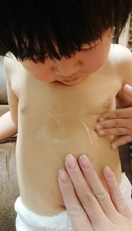 薬用モイストクリーム/MEDIBABY/フェイスクリームを使ったクチコミ(3枚目)