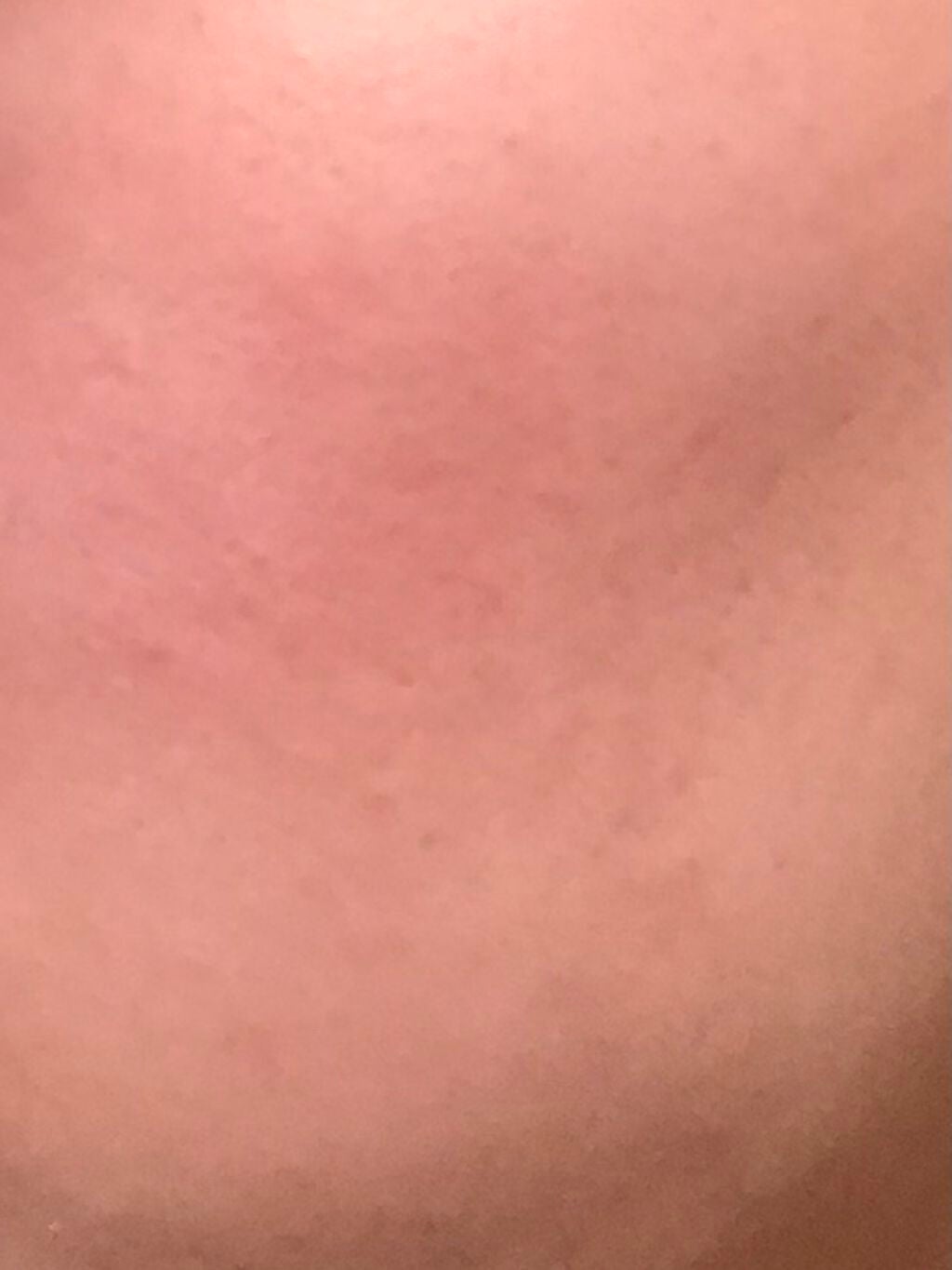 艶肌ドロップ/ラッシュ/美容液を使ったクチコミ(3枚目)