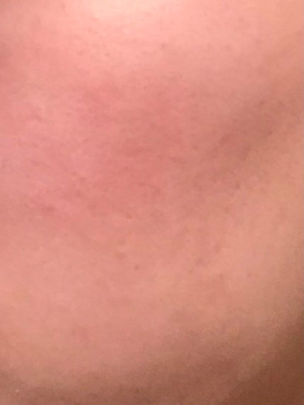 艶肌ドロップ/ラッシュ/美容液を使ったクチコミ(3枚目)