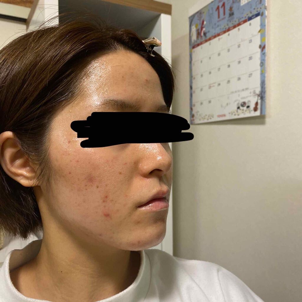 UVマイルドジェルN/マミー/日焼け止めジェルを使ったクチコミ（2枚目）