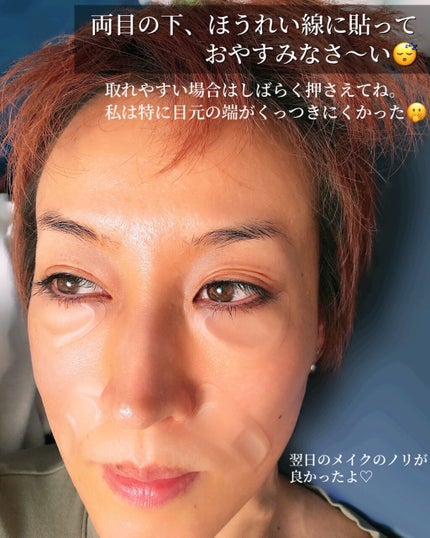 メディリフト 3Dマイクロフィラー(口元用)/YA-MAN TOKYO JAPAN/シートマスク・パックを使ったクチコミ(7枚目)