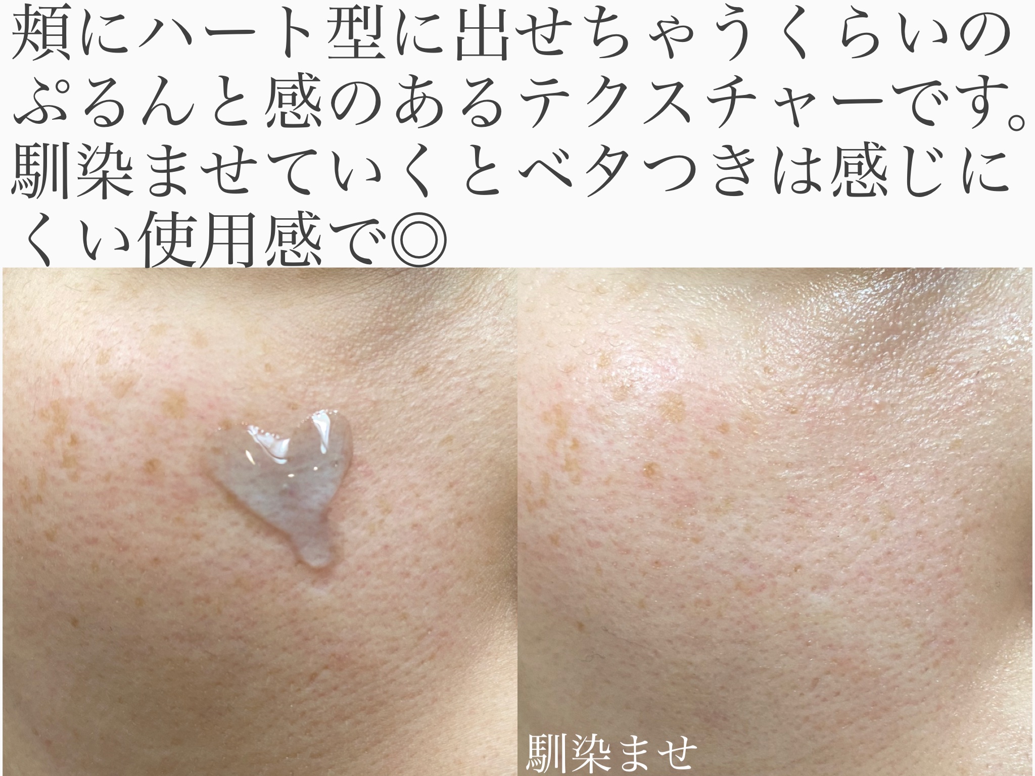 ディープブーストセラム/ブルーミオ/美容液を使ったクチコミ（2枚目）