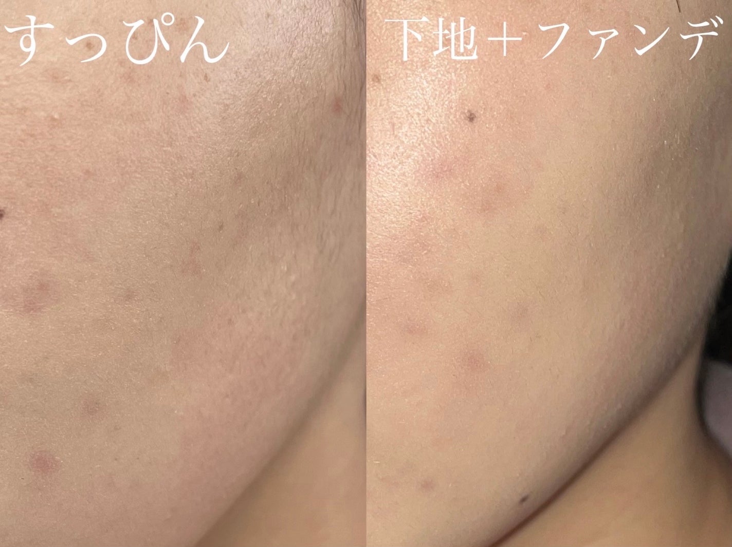 エッセンス スキングロウ ファンデーション/SHISEIDO/リキッドファンデーションを使ったクチコミ(4枚目)