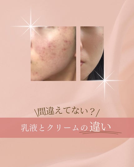ã¿ãð¹ on LIPS ãâ ïžä¿æ¹¿ã±ã¢ãããäžã§ã®æ³šæç¹ééããŠãªãïŒ/乳液ãšã¯ãªãŒã ã®..ãïŒ1æç®ïŒ