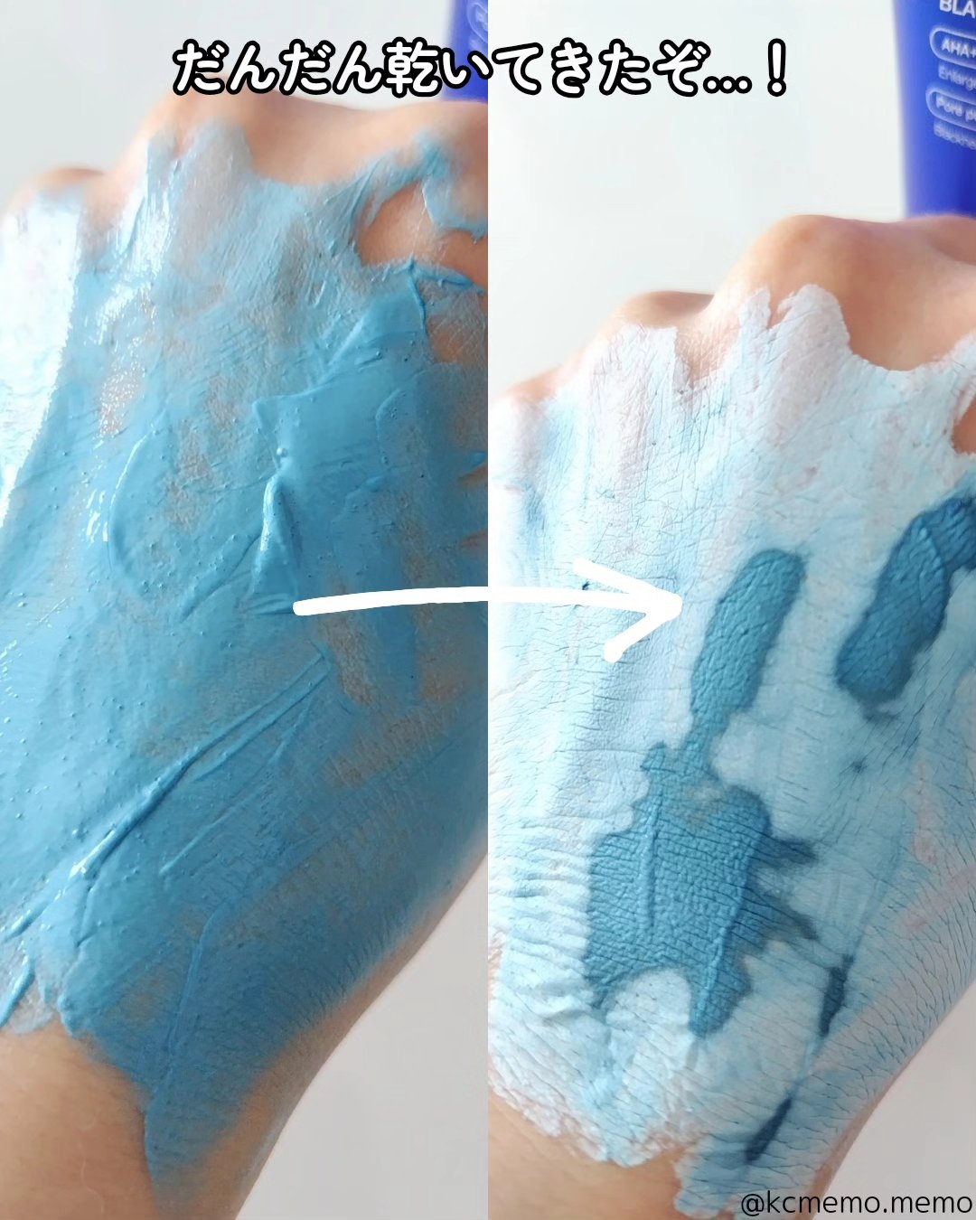 ゼロ毛穴パッド 2.0/MEDICUBE/トナーパッドを使ったクチコミ（3枚目）