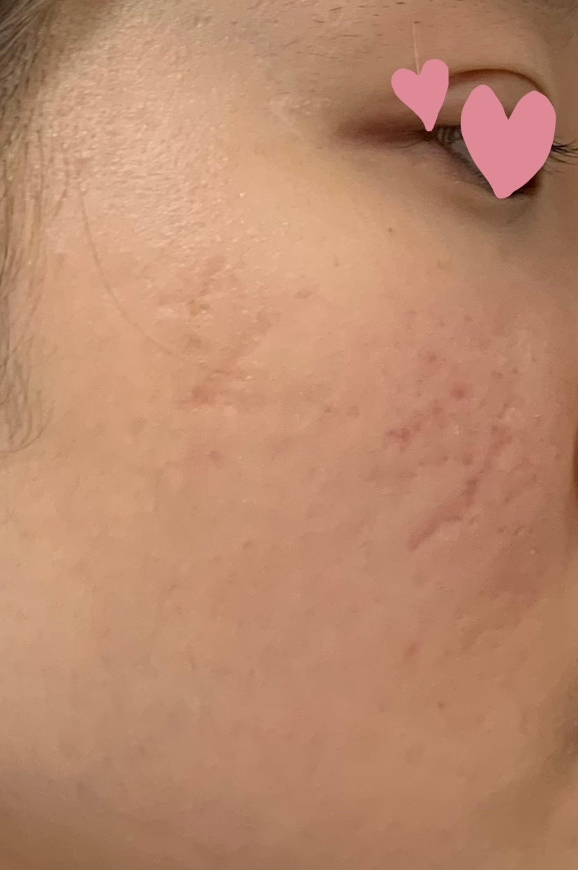 マイルドジェルクレンジング/無印良品/クレンジングジェルを使ったクチコミ(3枚目)