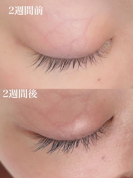 ごんす@YouTube始めました on LIPS 「《まつ育成長過程2週間経過❤︎》リノクル ディアモストアイラッ..」(5枚目)