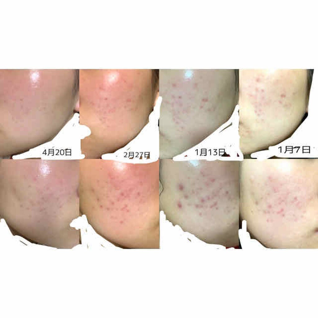 ドクタージャルト シカペア クリーム (第2世代)/Dr.Jart+/フェイスクリームを使ったクチコミ(2枚目)