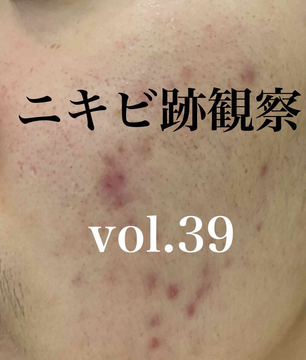 Cセラム/b.glen/美容液を使ったクチコミ（1枚目）