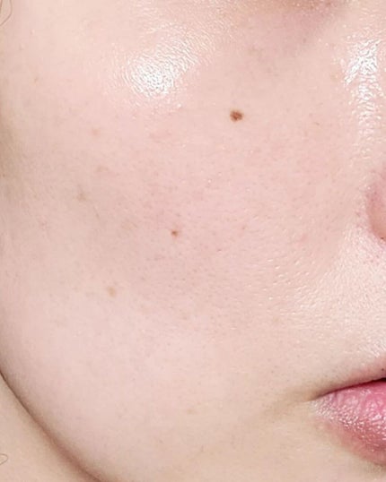 AHA 30% + BHA 2% Peeling Solution/The Ordinary/ピーリングを使ったクチコミ(8枚目)