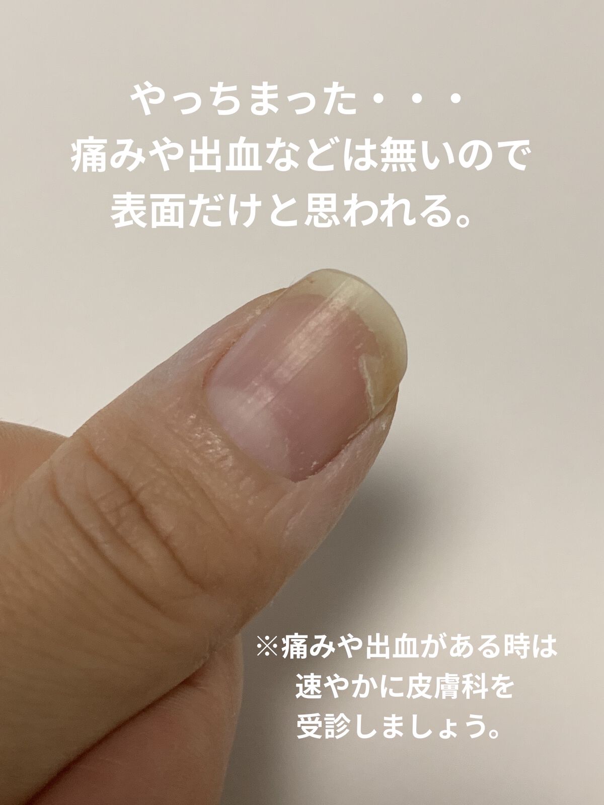 ネイルファイル/ビューティーワールド/ネイル用品を使ったクチコミ（2枚目）