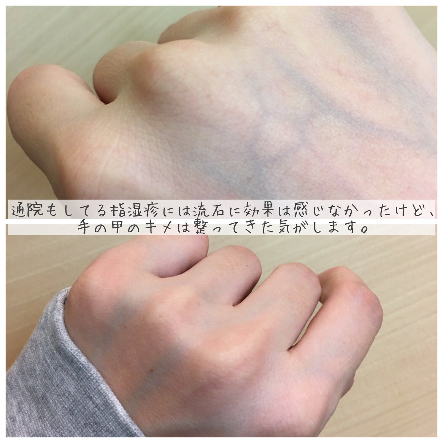 アクアテクトゲル/アクシリオ/オールインワン化粧品を使ったクチコミ(3枚目)