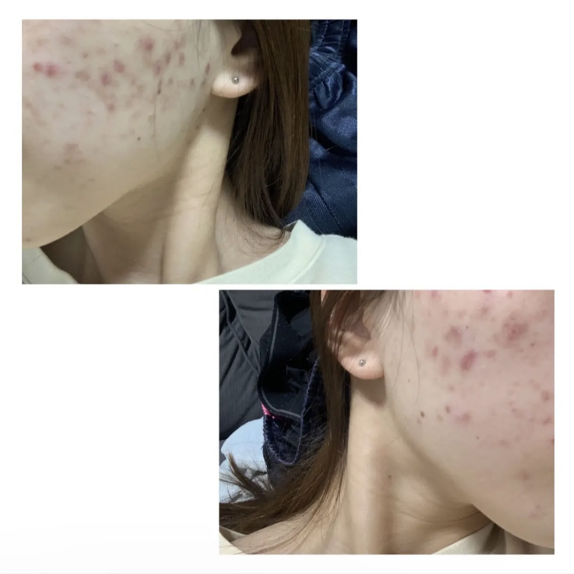 白潤プレミアム薬用浸透美白化粧水/肌ラボ/化粧水を使ったクチコミ（2枚目）