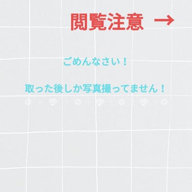 角質ふきとり美容化粧水/ネイチャーコンク/拭き取り化粧水を使ったクチコミ（2枚目）