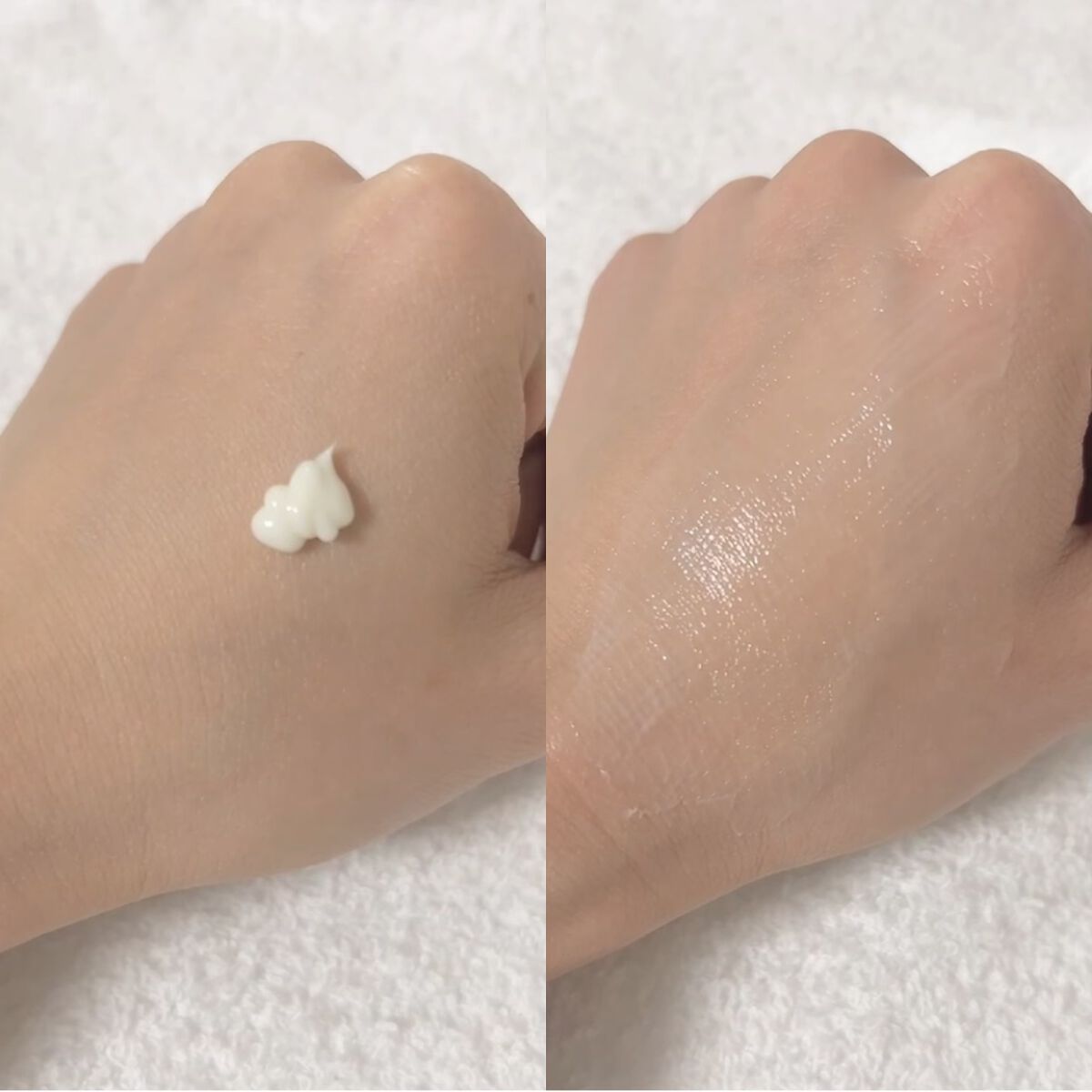 シカレチA クリーム0.05/VT/フェイスクリームを使ったクチコミ（2枚目）