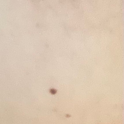 ヒアルロン酸原液/太陽のアロエ社/美容液を使ったクチコミ(5枚目)