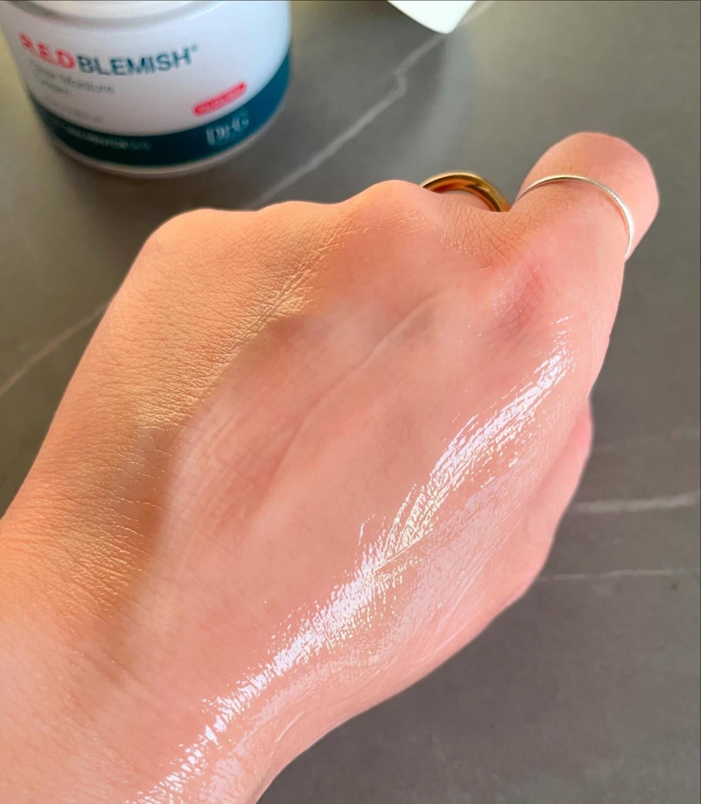 レッドブレミッシュ クリアモイスチャークリーム/Dr.G/フェイスクリームを使ったクチコミ(5枚目)