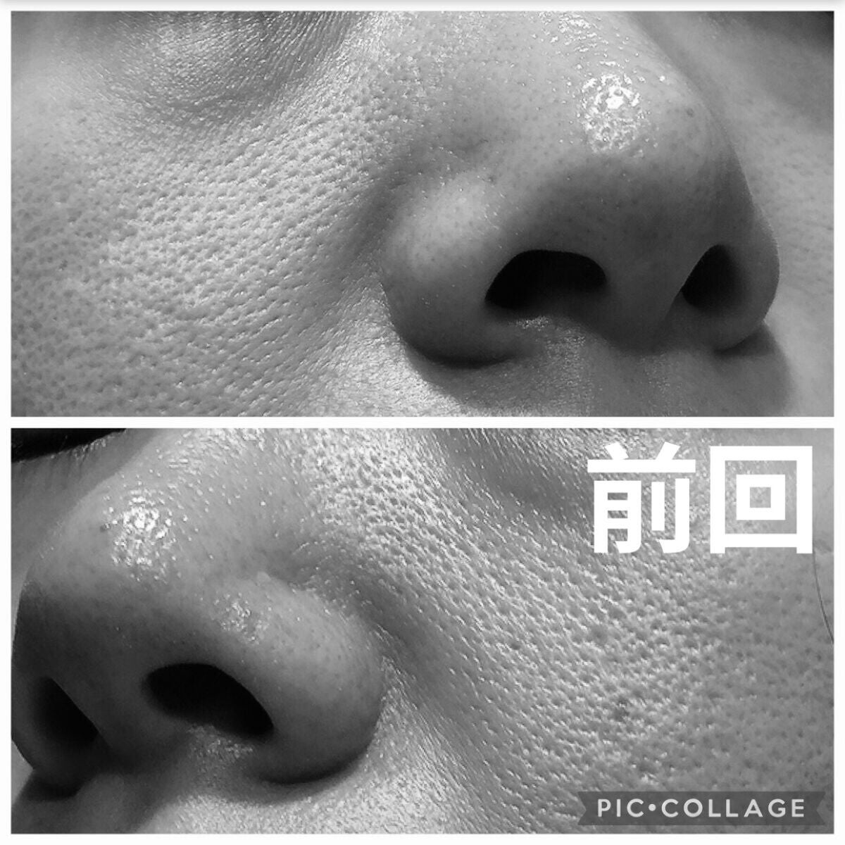 ガラクナイアシン2.0エッセンス/manyo/美容液を使ったクチコミ(3枚目)