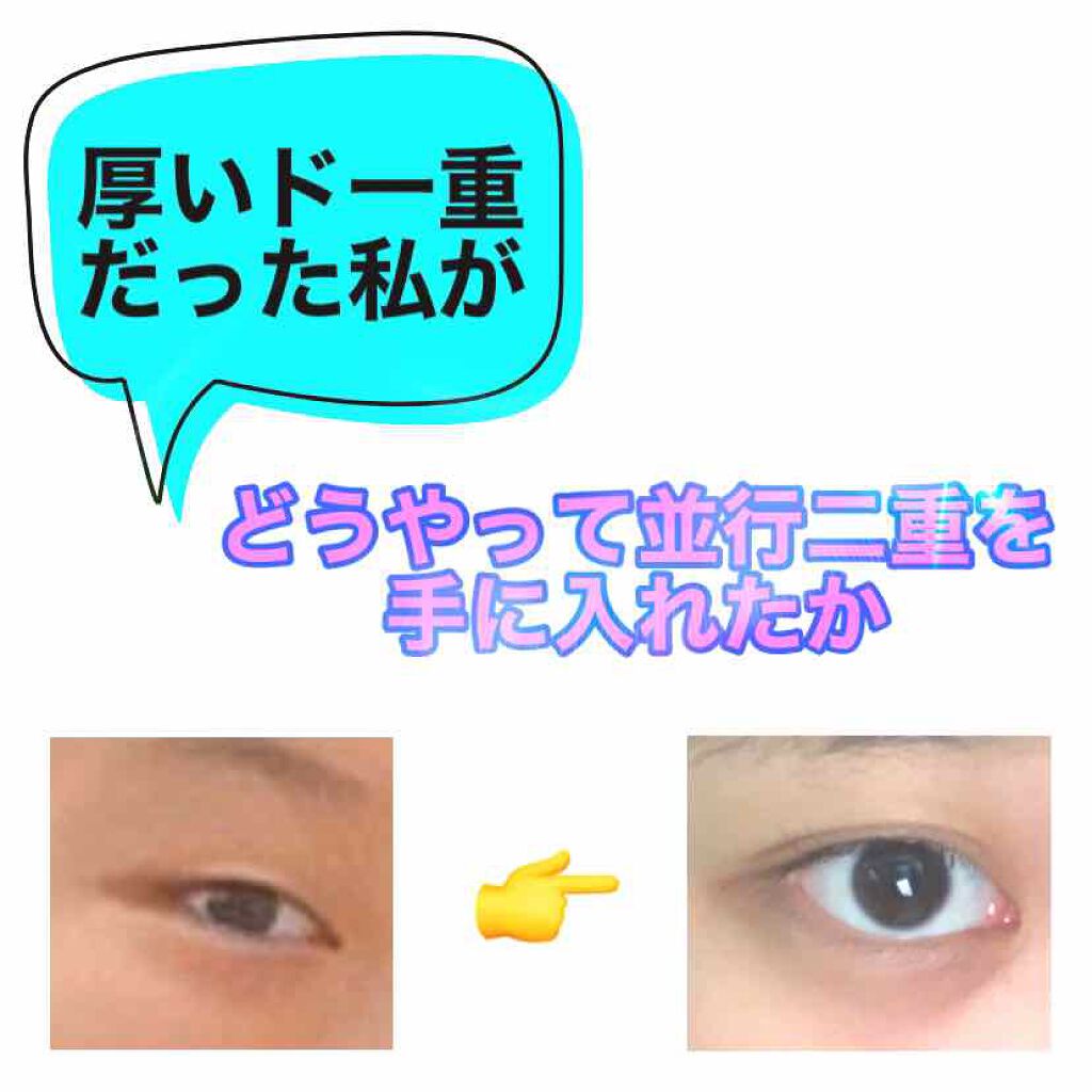 ワンダーアイリッドテープ Extra/D-UP/二重まぶた用アイテムを使ったクチコミ(1枚目)