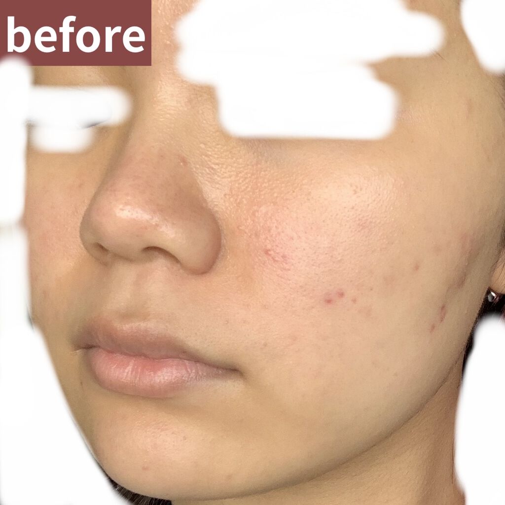 UVイデア XL プロテクショントーンアップ/ラ ロッシュ ポゼ/日焼け止めクリームを使ったクチコミ（2枚目）