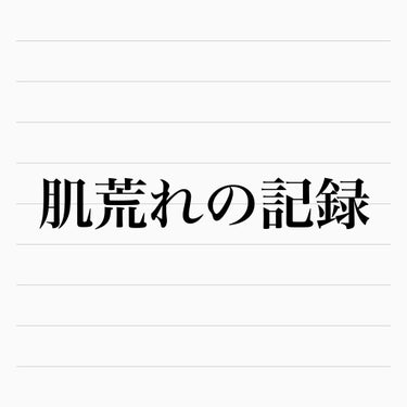 肌の調子が悪いので記録


昨日の夜から肌の調子が悪いです🥲

化粧を落として洗顔するまではなんともなかった。
だけど昨晩、
お風呂あがりにミノンの化粧水がしみた…！
これは初めてでまずいなあと感じる…