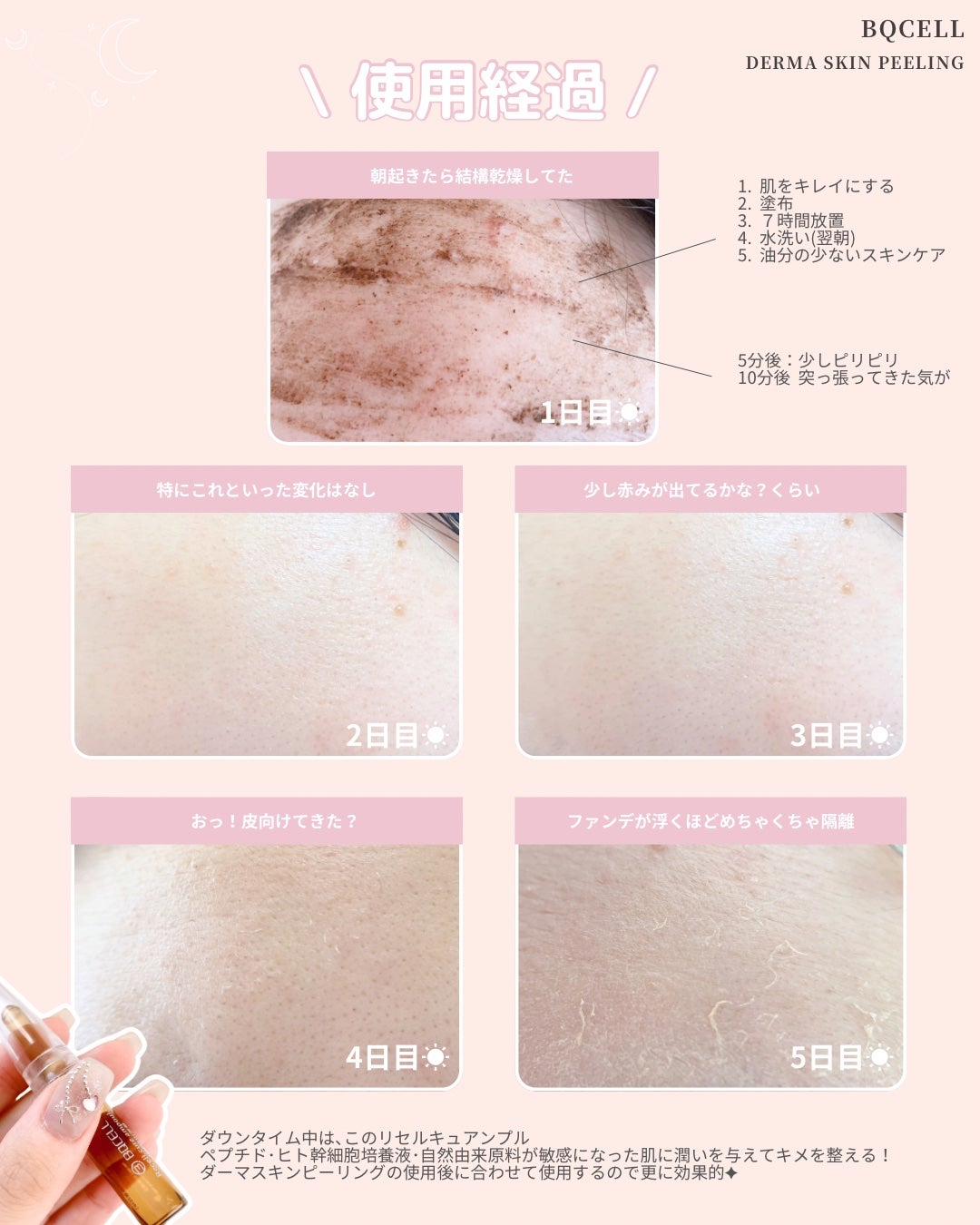 ダーマスキンピーリング/BQCELL/その他キットセットを使ったクチコミ(5枚目)