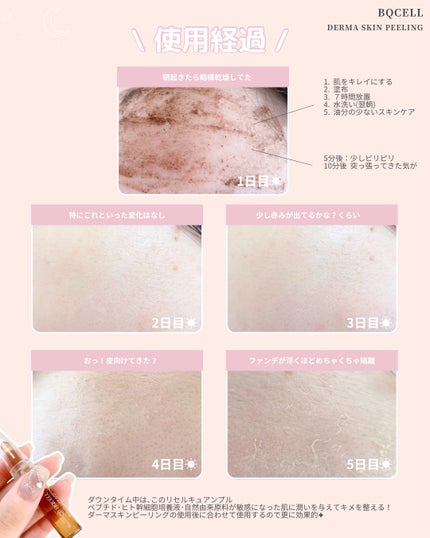 ダーマスキンピーリング/BQCELL/その他キットセットを使ったクチコミ(5枚目)