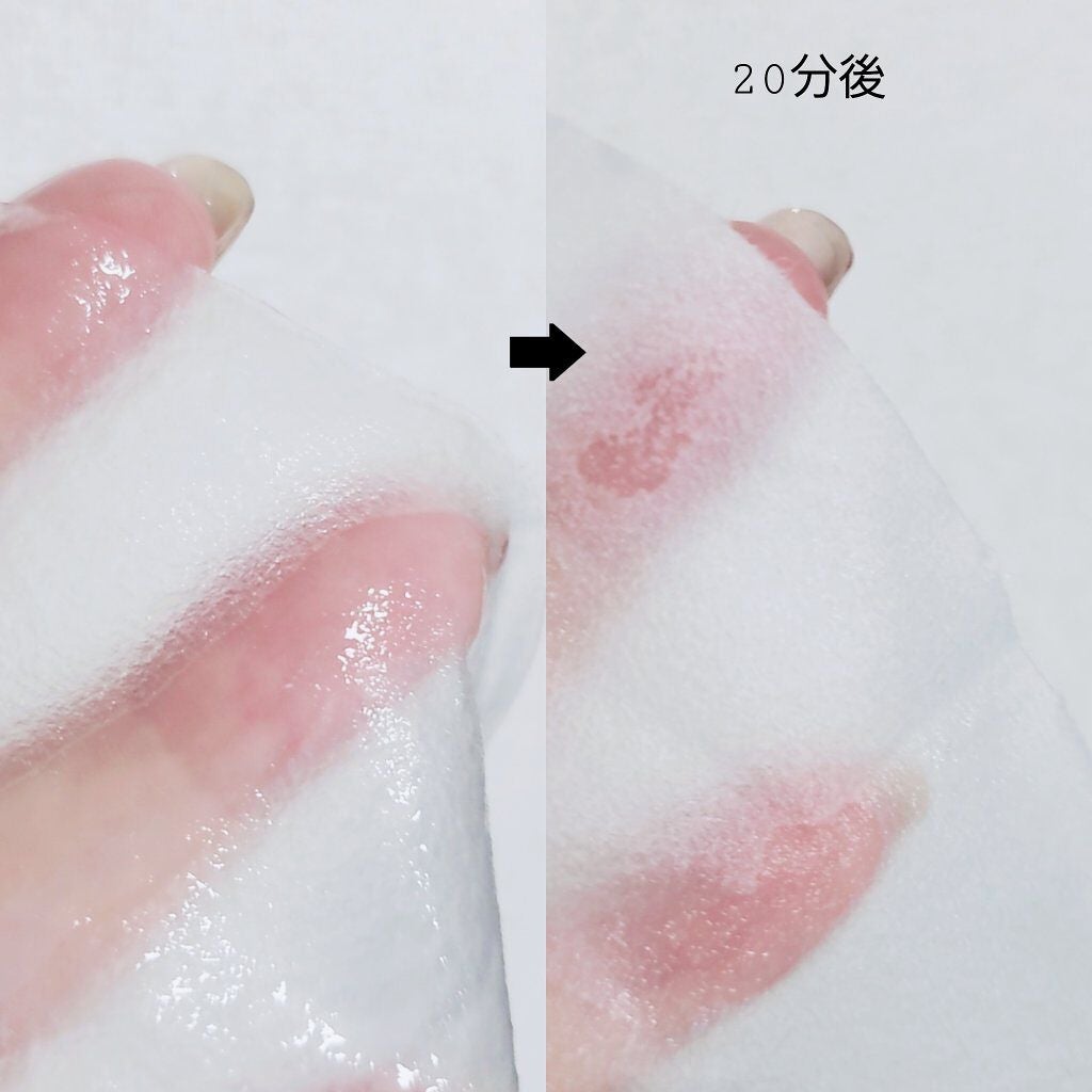 シカフルカーミングマスク/beplain/シートマスク・パックを使ったクチコミ(3枚目)