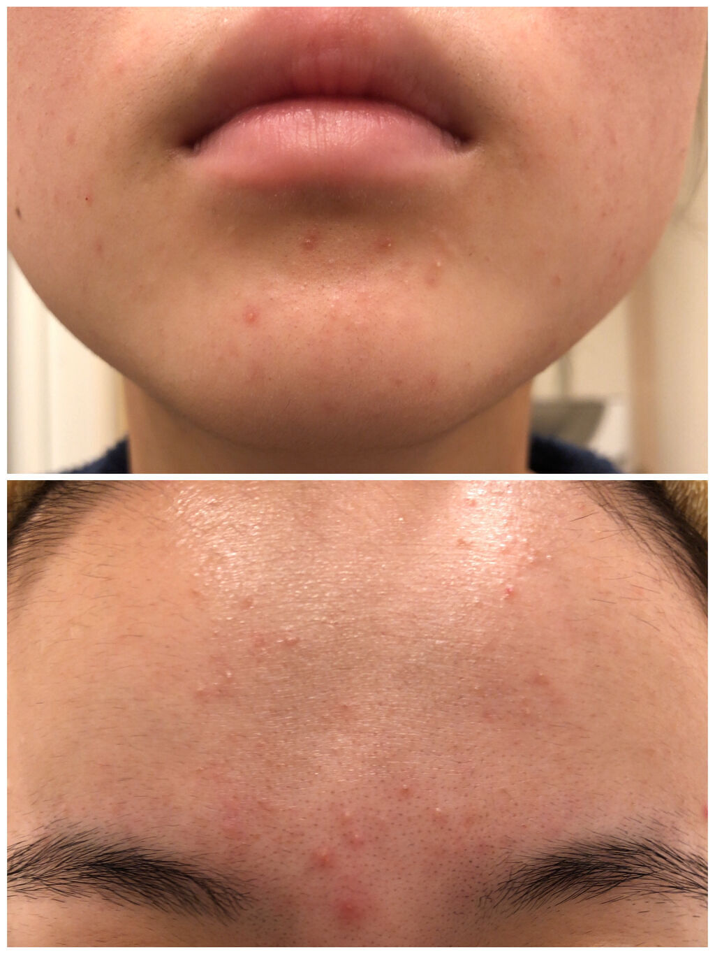 DHC はとむぎエキス/DHC/健康サプリメントを使ったクチコミ（3枚目）