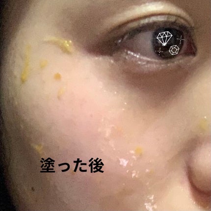 リアルカレンデュラピールオフパック/APRILSKIN/ピーリングを使ったクチコミ(3枚目)