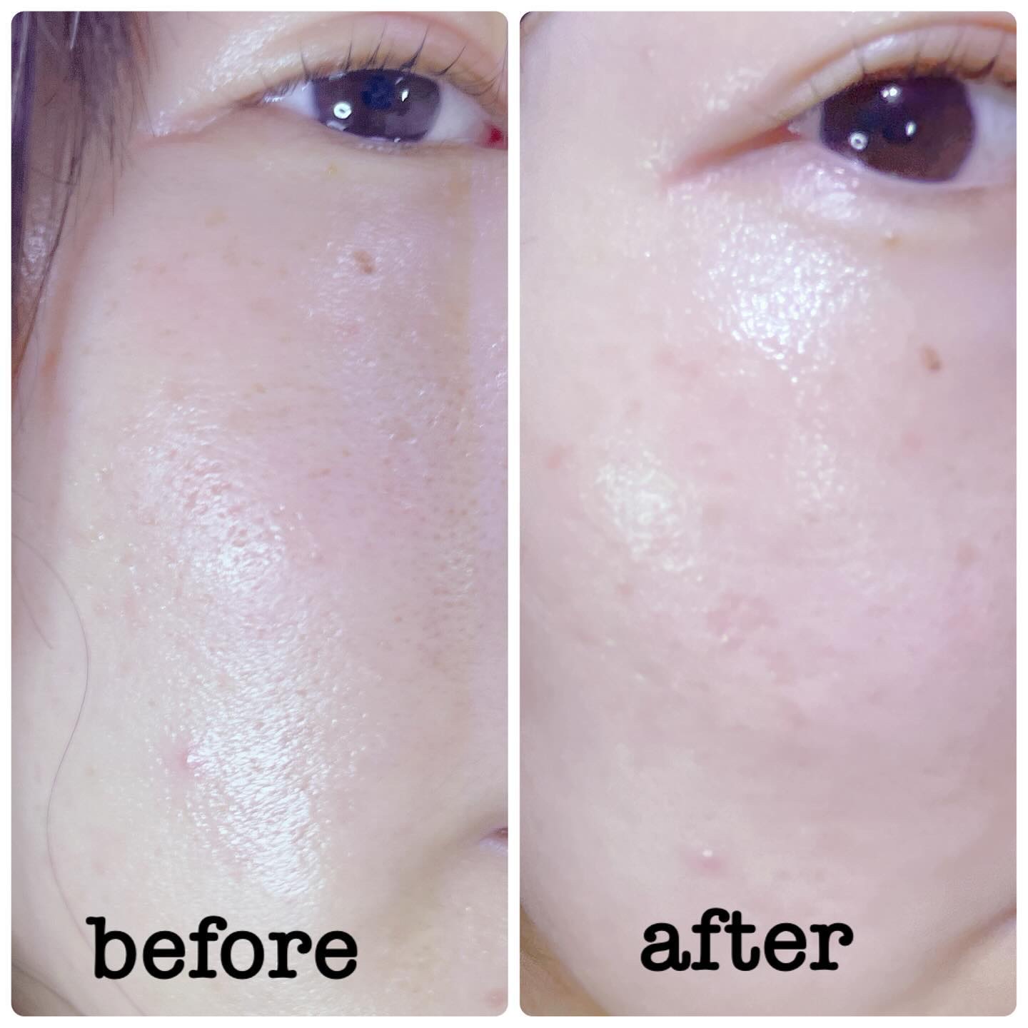 ノルディック氷河水スリーピングパック/LUOKI/フェイスクリームを使ったクチコミ（3枚目）