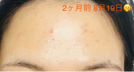 ザビタミンC23/IOPE/美容液を使ったクチコミ(2枚目)