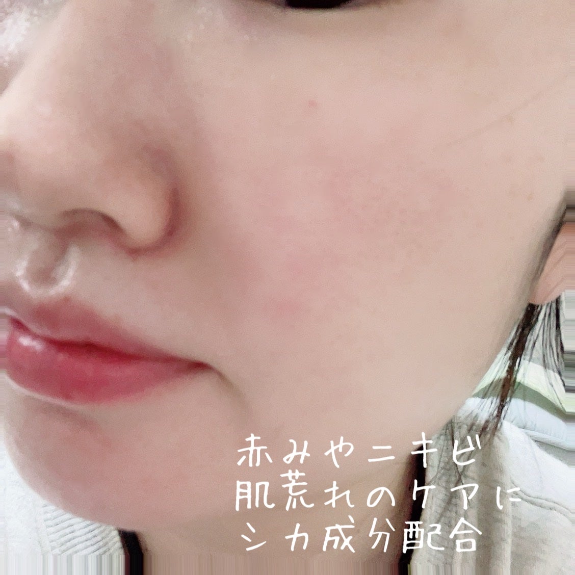 レッドブレミッシュ クリアスージングクリーム/Dr.G/フェイスクリームを使ったクチコミ(3枚目)