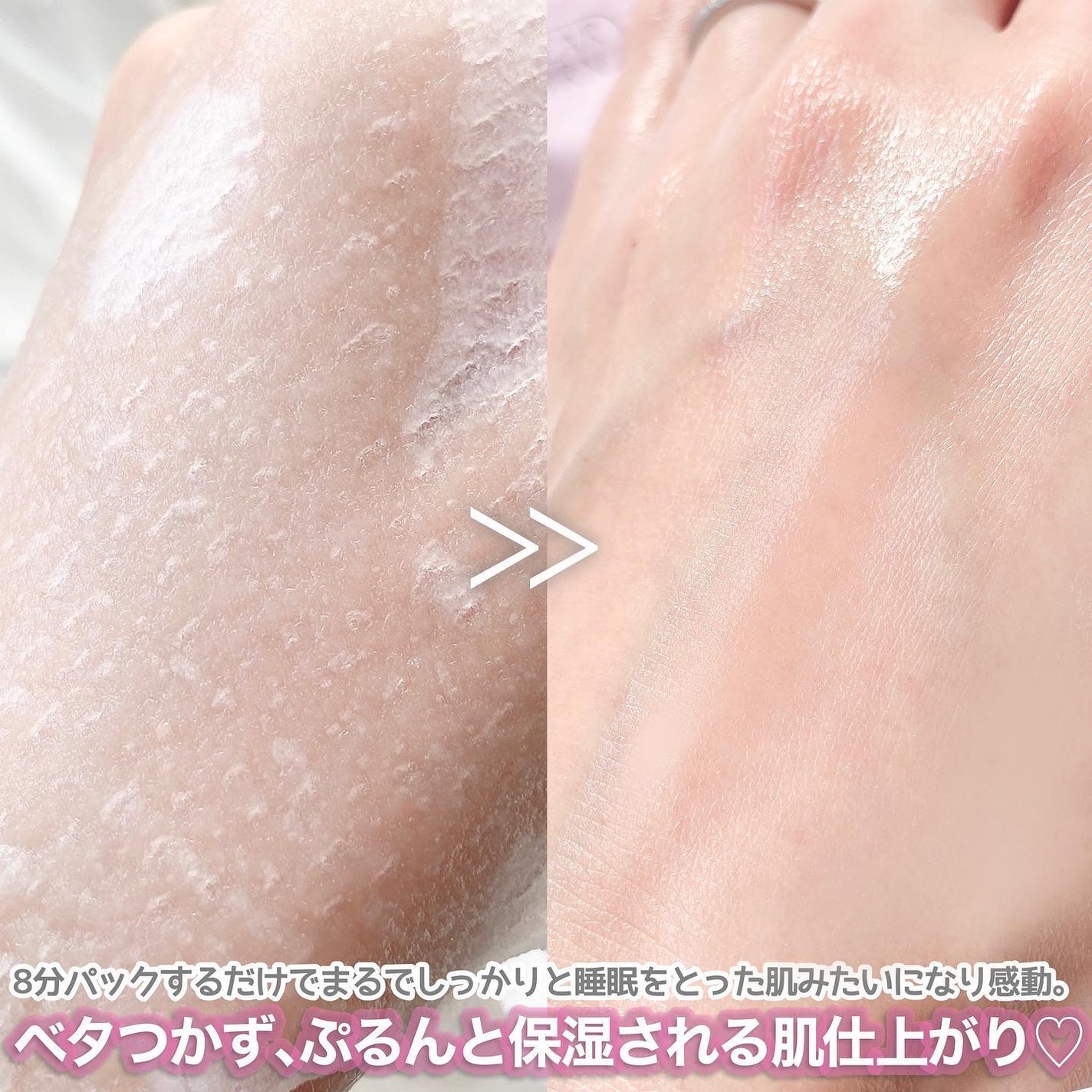 ごめんね素肌マスク/クリアターン/シートマスク・パックを使ったクチコミ(5枚目)