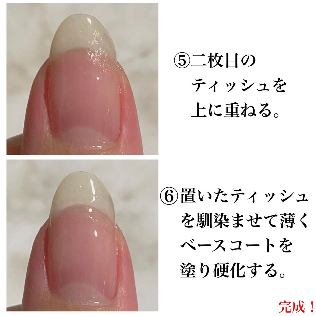 引き付ける 運賃 静的 ジェル ネイル ティッシュ 補強 糸 コンクリート マーティンルーサーキングジュニア