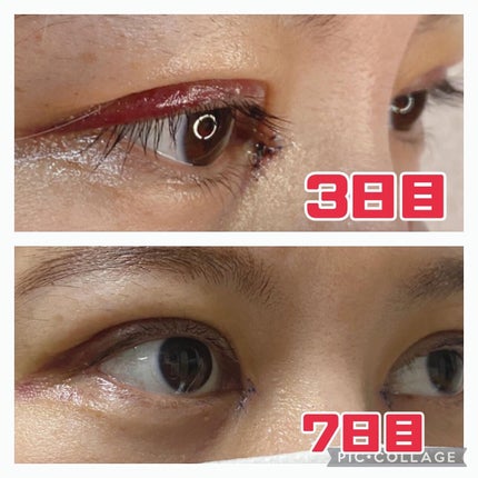 を使ったクチコミ(3枚目)