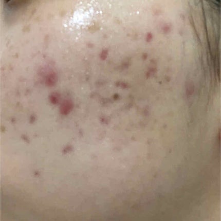 ヴァセリン アドバンスドリペア ボディローション 無香料/ヴァセリン/ボディローションを使ったクチコミ(2枚目)