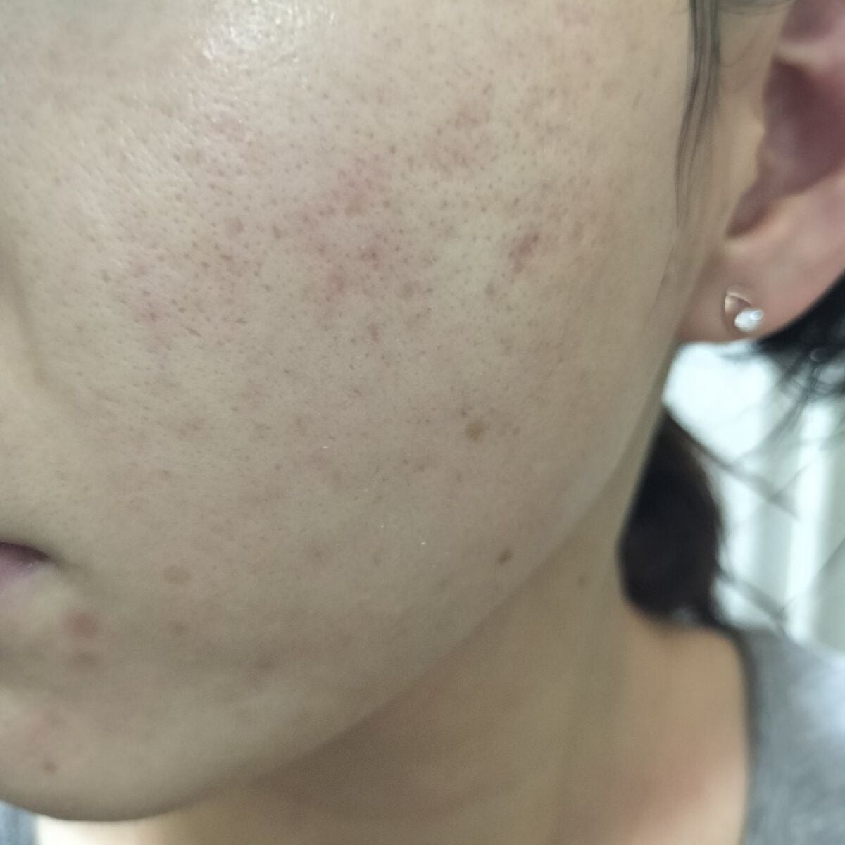 miina@汚肌工事録⚠️ on LIPS 「10/16の#汚肌工事録ありがとう🐰🐰/写真下手だけど疲れを何..」(2枚目)