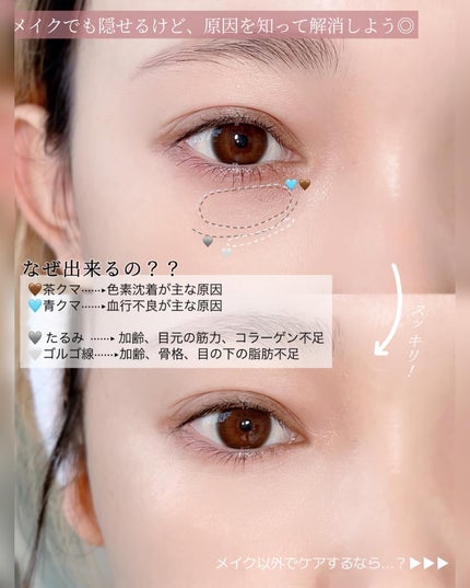 Karin.ðŠâªï¿€ã«ã©ã³ã³ã¬ãðïœLens Log  on LIPS ãæ©ã¿å¥è§£æ¶æ³âä¿åçâ//ç®å
ã®ã¯ããããã¿ã®æ©ã¿ãããèããŸ..ãïŒ6æç®ïŒ