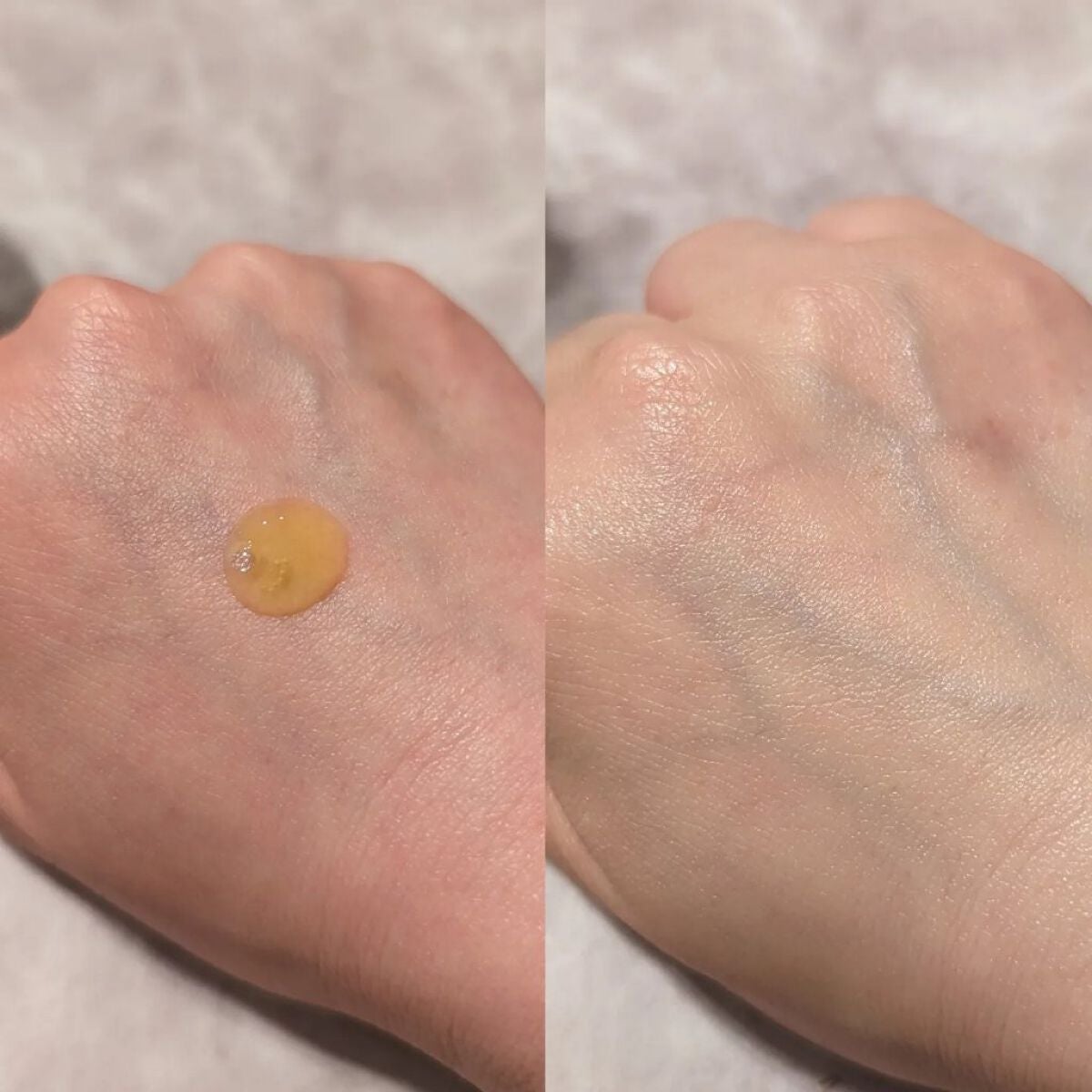 ミシャ ビタシープラス 美容液【日本処方】/MISSHA/美容液を使ったクチコミ(2枚目)