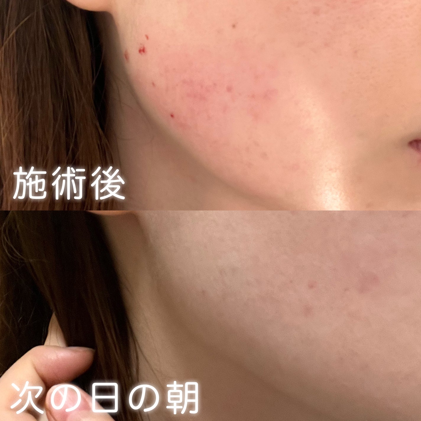 ブルーブライトマスク/EMROSÉ/シートマスク・パックを使ったクチコミ(2枚目)