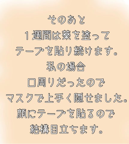 みーくん on LIPS 「1ヶ月前に顔のホクロを取りました。他の人からしたら対して気にな..」(5枚目)