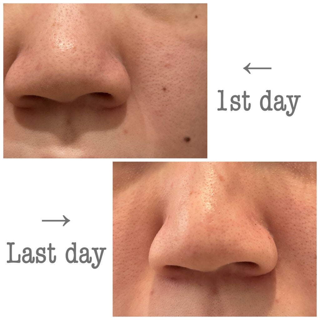 ホットクレンジングゲル マッサージプラス/マナラ/クレンジングジェルを使ったクチコミ(2枚目)