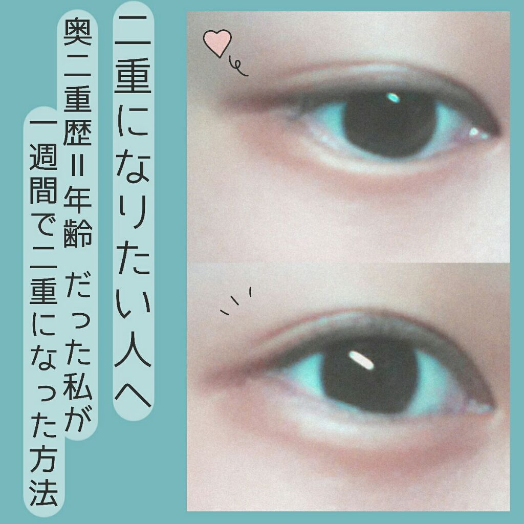 絆創膏/DAISO/その他を使ったクチコミ（1枚目）