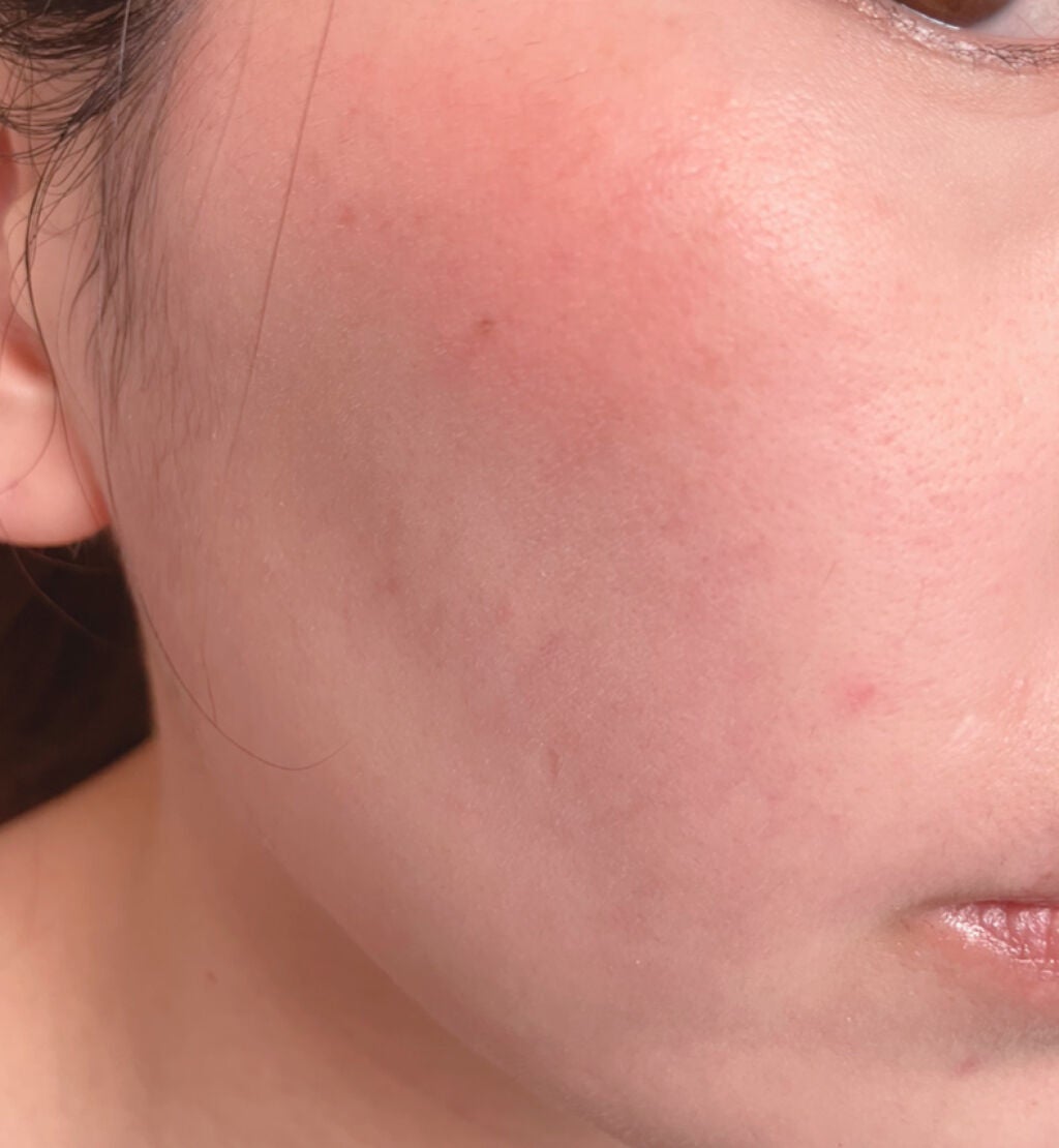 プリズム・リーブル・ブラッシュ/GIVENCHY/パウダーチークを使ったクチコミ(2枚目)