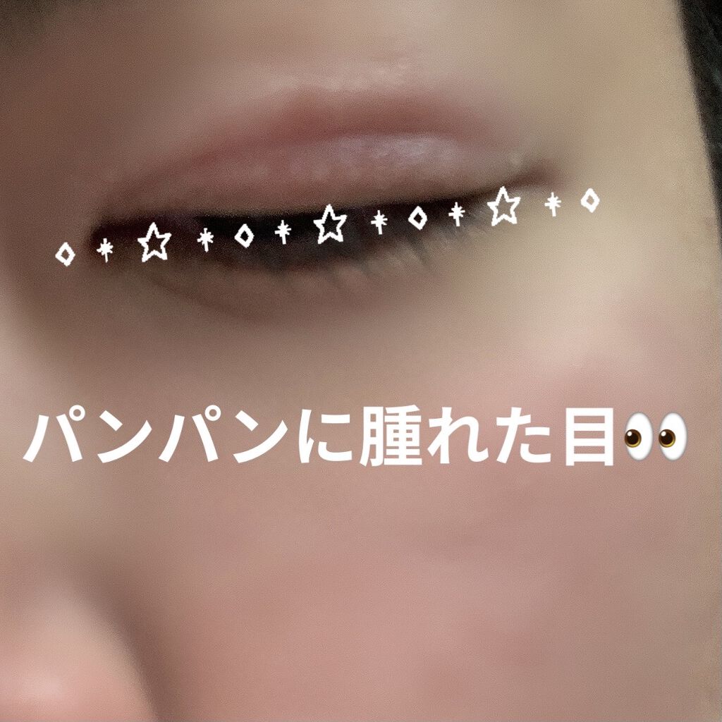 キュアレア（医薬品）/キュアレアa/その他を使ったクチコミ（2枚目）